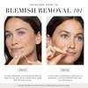 image:imageTweezerman Whitehead and Blackhead Remover Rose GoldRose Gold