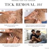 image:imageTweezerman Pet Tick Removal Tweezer Tick Removal Tool for Dogs and Cats